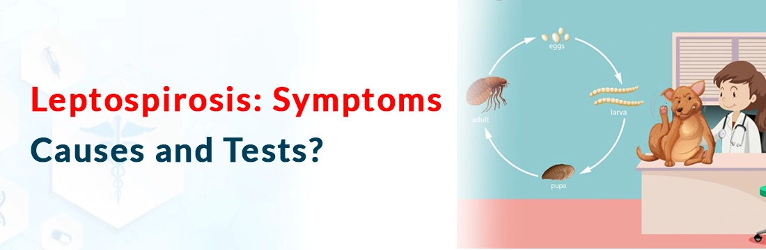  Leptospirosis: Symptoms, Causes and Tests?